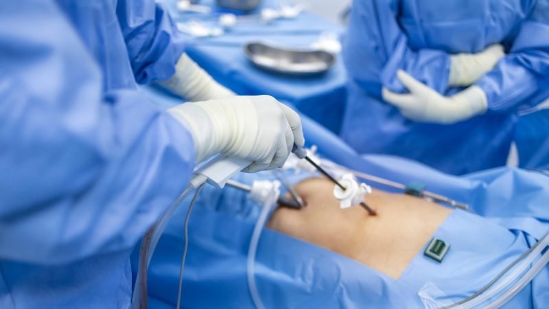 Banner-Top-Cirujano-texcoco